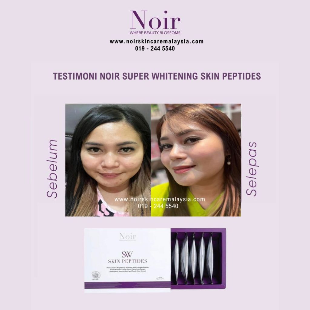 noir beauty noir skincare testimoni review feedback noir super whitening skin peptides